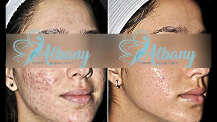 Image for Albany Cosmetic and Laser Centre with ID of: 3017113