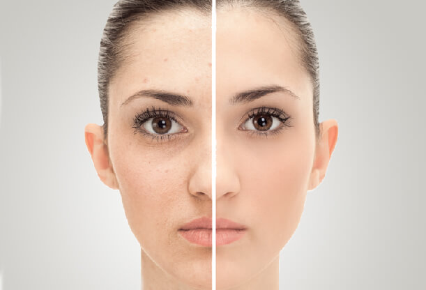 Image for Pigmented Lesion Treatment Market, By Laser Type, - Global Industry Insights, Trends, Outlook, and Opportunity Analysis, 2018-2026 with ID of: 3030555