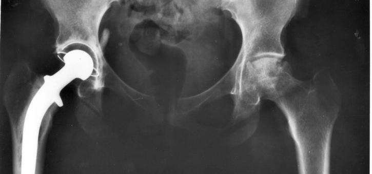 Image for Antibiotic Bone Cement and Casting Materials Market, by Materials, Application, End User and Geography - Global Industry Insights, Trends, Outlook, and Opportunity Analysis, 2018–2026 with ID of: 3033698