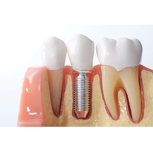 Image for Connecticut Ave Cosmetic Dentistry with ID of: 3047127
