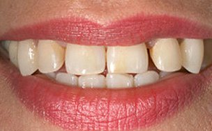 Image for Gingivitis Treatment Center Brooklyn with ID of: 3063212
