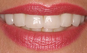Image for Gingivitis Treatment Center Brooklyn with ID of: 3063213