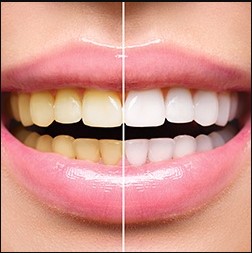 Image for Eccella Smiles with ID of: 3065276