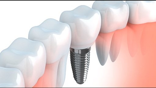 Image for Eccella Smiles with ID of: 3065277