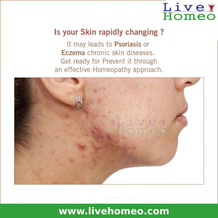 Image for Homeopathy treatment for skin problems with ID of: 3065746