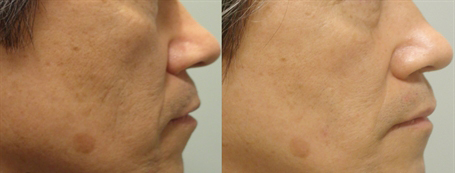 Image for Dr. Jacob Rispler's Laser & Dermatology Institute - L.D.I of Covina with ID of: 3079923