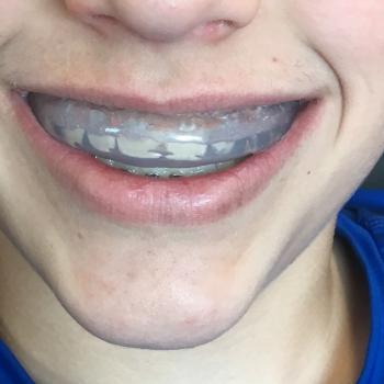 Image for Kaelin Pediatric Dentistry with ID of: 3079924