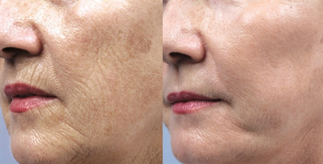 Image for Dr. Jacob Rispler's Laser & Dermatology Institute - L.D.I of Los Angeles with ID of: 3080102