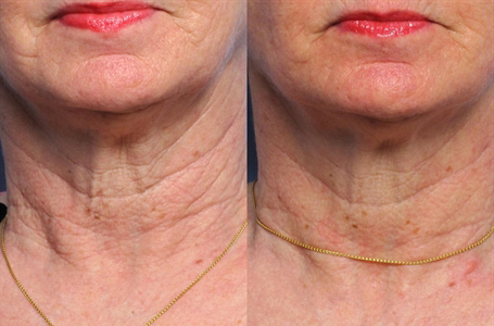 Image for Dr. Jacob Rispler's Laser & Dermatology Institute - L.D.I of Los Angeles with ID of: 3080104