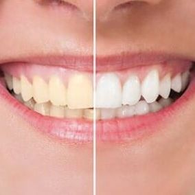 Image for Choice Dental with ID of: 3110775