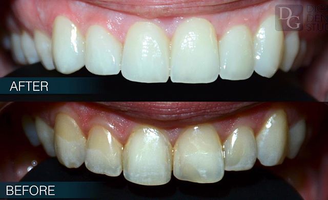 Image for Dental Crowns Lab Edison with ID of: 3115110