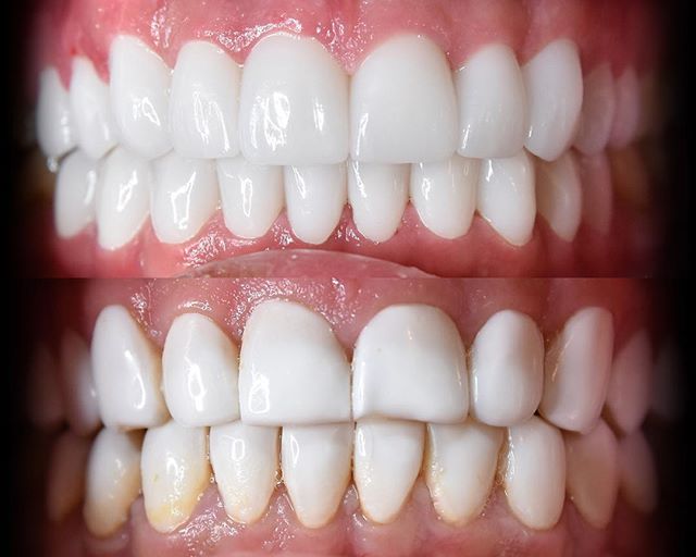 Image for Dental Crowns Lab Edison with ID of: 3115115