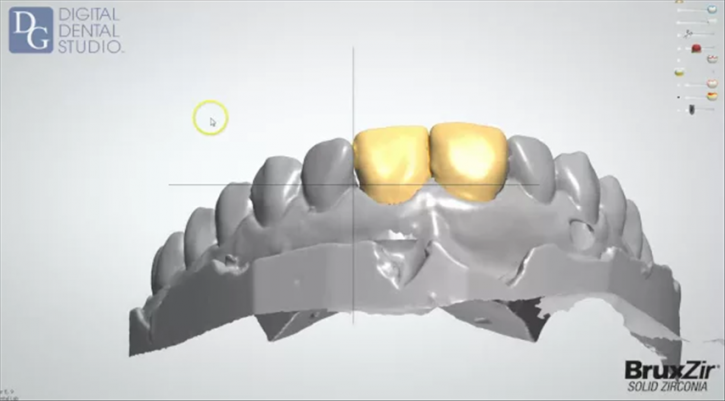Image for Dental Crowns Lab Edison with ID of: 3115121
