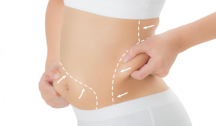 Image for Get the best and Affordable Fat Removal Treatment in Hamilton, Canada | NewAgeLaser with ID of: 3128419