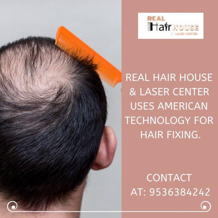 Image for Hair patch in Delhi with ID of: 3133727