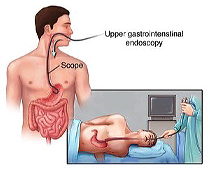 Image for Endoscopy Test Cost In Kolkata, Specialist Doctors | Credihealth with ID of: 3136201