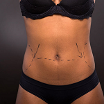 Image for Yardley Plastic and Reconstructive Surgery with ID of: 3175698