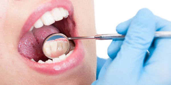 Image for Santry Dental with ID of: 3178200
