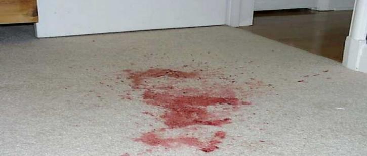 Image for How to Remove Blood Stains from Carpet with ID of: 3180783