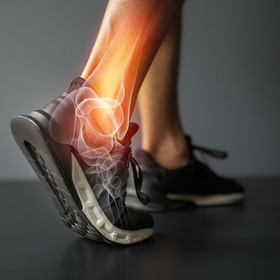 Image for Texas Muscle Activation with ID of: 3186584