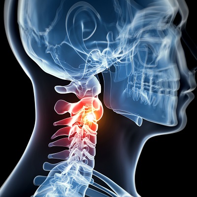 Image for Texas Muscle Activation with ID of: 3186586