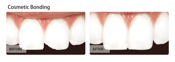 Image for Apple tree Dentistry with ID of: 3188117