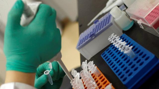 Image for In-vitro Diagnostics (IVD) Market - Size, Share and Forecast to 2024 with ID of: 3192983