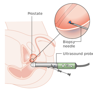 Image for Global Prostate Biopsy Devices Market Analysis- Application, Type, Voltage, End-User, Category, Global Trends and Forecast To 2024 with ID of: 3203408