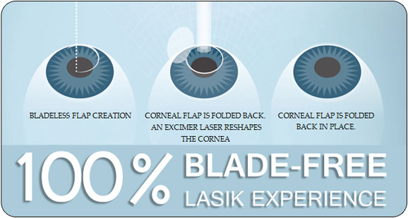Image for Denver Lasik Vision Center with ID of: 3206264