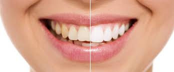 Image for Cosmetic Dentistry Market An Array Of Graphics And SWOT Analysis of Major Industry Segments with ID of: 3211123