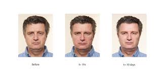 Image for Top Three Reasons to Undergo Plastic Surgery with ID of: 3216947