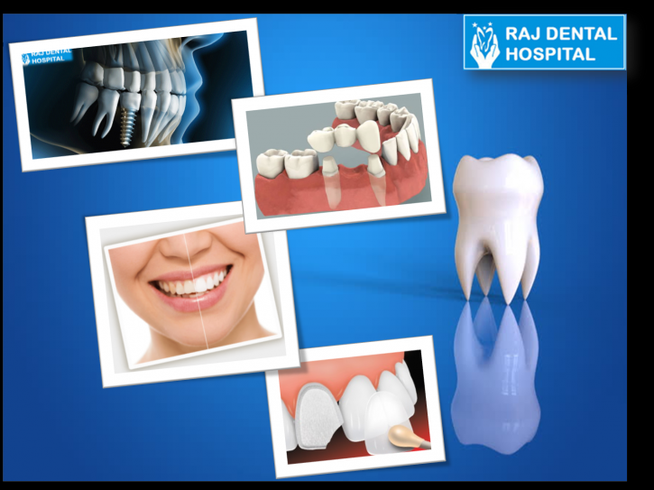 Image for Importance of Regular visit the Dentist with ID of: 3221240