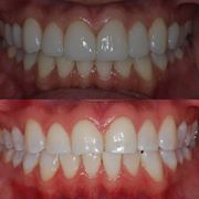 Image for Emergency Dentist Park Slope with ID of: 3221601