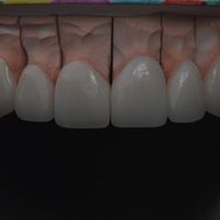 Image for Emergency Dentist Park Slope with ID of: 3221605