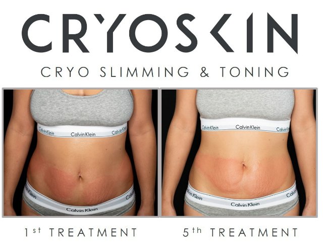 Image for Texas Cryo Solutions-Frisco with ID of: 3225621