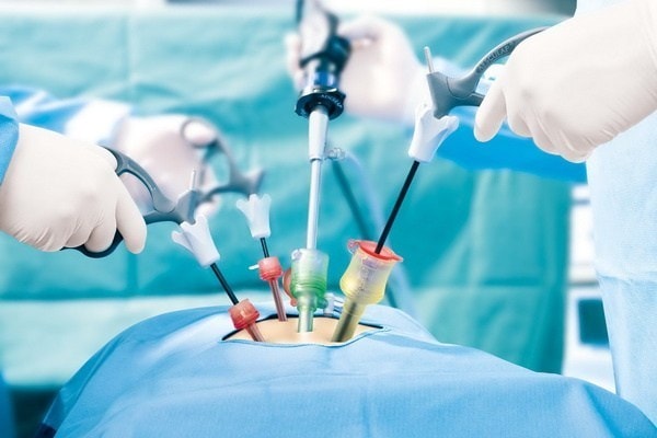 Image for Sinus Dilation Devices Market - Size, Share, Analysis, and Forecast, 2018 – 2026 with ID of: 3232522