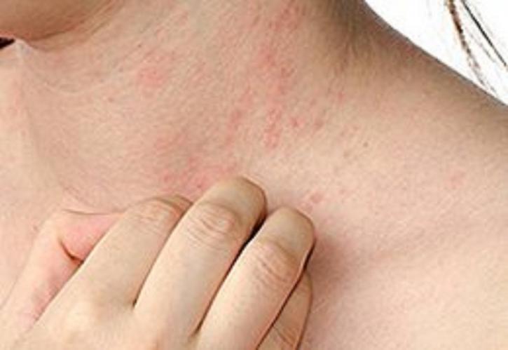 Image for Manhattan Dermatology Specialists with ID of: 3235637
