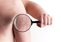 Image for Manhattan Dermatology Specialists with ID of: 3235674