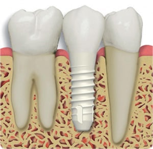 Image for Maryland Holistic Dentist with ID of: 3251552