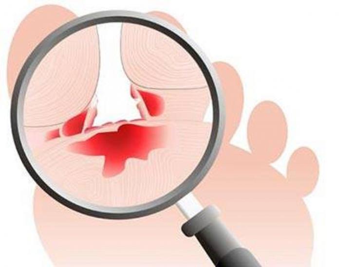 Image for Bunion Surgery Specialists with ID of: 3261655