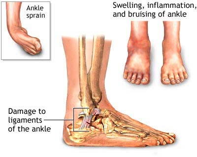 Image for Bunion Surgery Specialists with ID of: 3261660