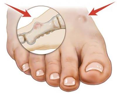 Image for Bunion Surgery Specialists with ID of: 3261662