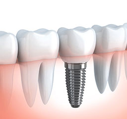Image for Select Dental Care with ID of: 3262632