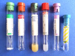 Image for Blood Coagulation Tubes 2018–2026: Analysis, Status, Type, Application, Regions, Market Size by Players with ID of: 3271258