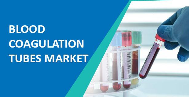 Image for Blood Coagulation Tubes 2018–2026: Analysis, Status, Type, Application, Regions, Market Size by Players with ID of: 3271339