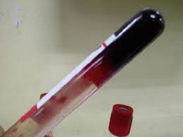Image for Blood Collection Tubes Market 2018 Target Client, Brand Strategy, Distributors, Marketing Channel Development and Trend to 2026 with ID of: 3280985