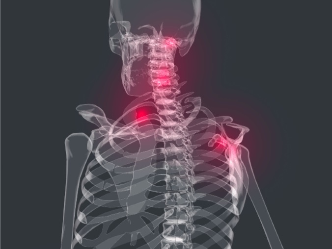 Image for Pietrek Spinal Care with ID of: 3287817