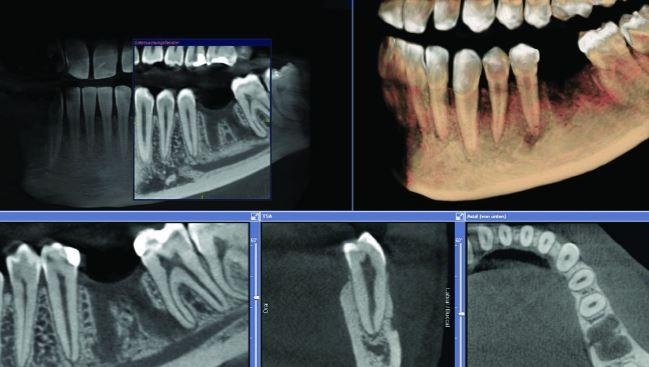 Image for Cone Beam Computed Tomography (CBCT) Market Revenue Growth Predicted by 2018-2026 with ID of: 3292889