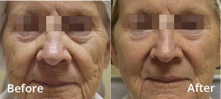 Image for Skin Spa New York - Back Bay with ID of: 3298915
