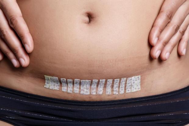 Image for C Section Cost In Kolkata - Online Appointment On Credihealth with ID of: 3326184